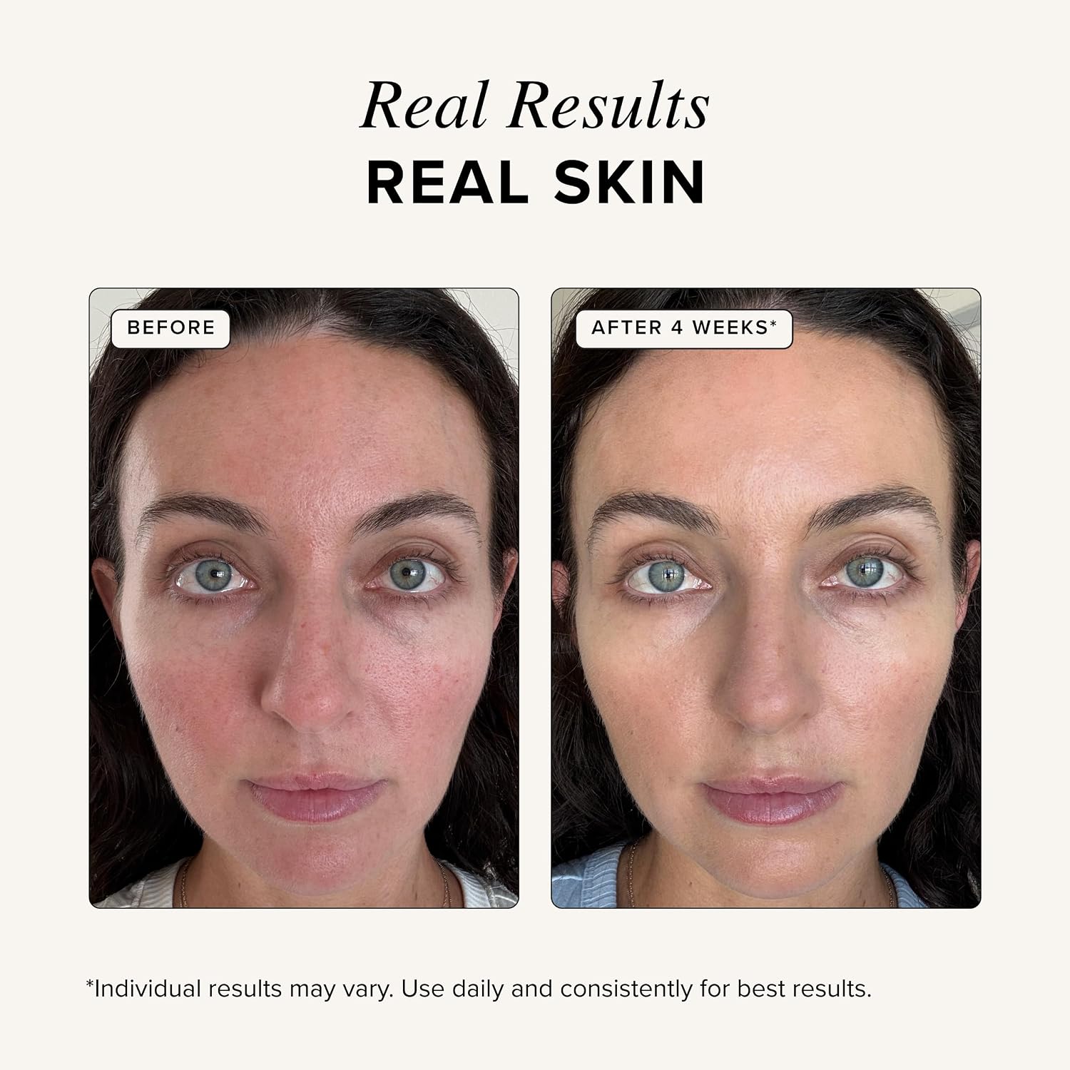 مصل الببتيد النحاسي المضاد للت - مراجعة Peptide Complex Serum وسعره